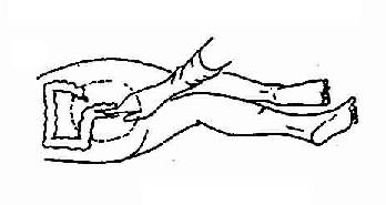 ��ת����˨