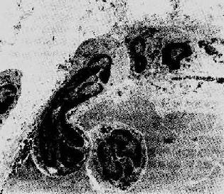 ������ϸ���ĸ��ں��γ�