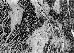 ��ɽ��֮�ļ�����