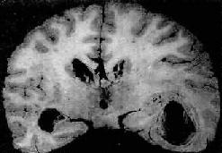 ������ŧ��